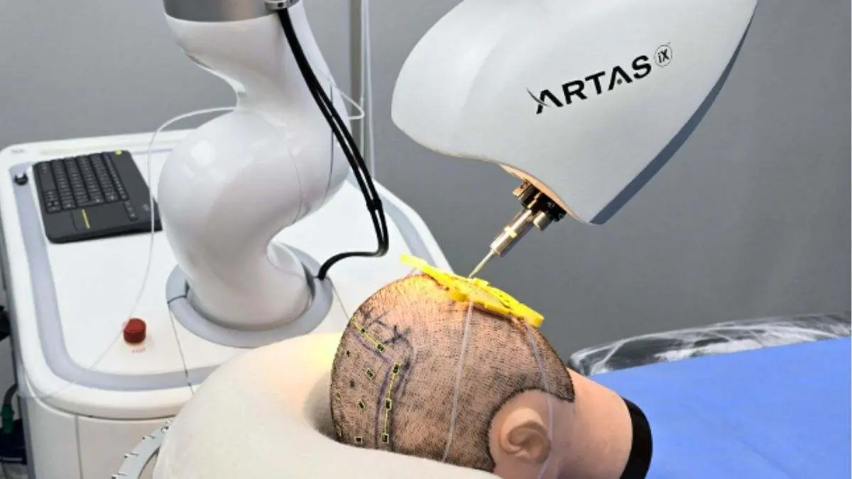 artas-ix-ia