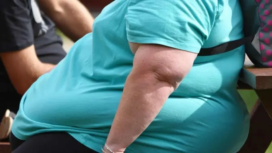 persona-obesa-77b99185-focus-0-0-896-504